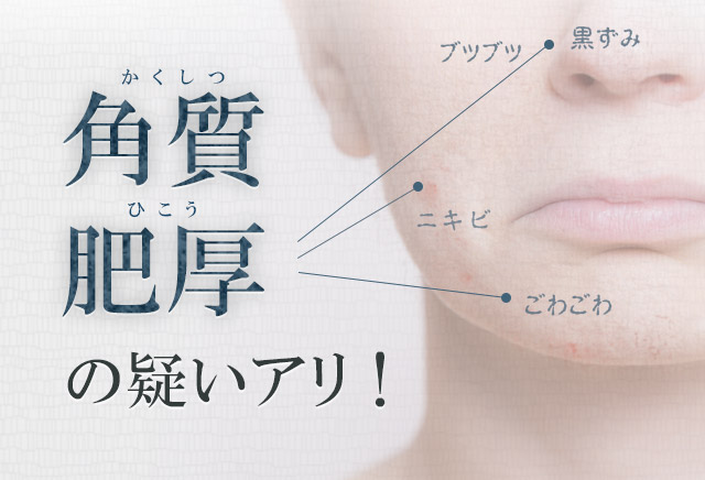 角質肥厚の疑いアリ!